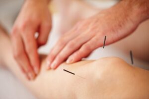 What diseases can acupuncture usually treat?
